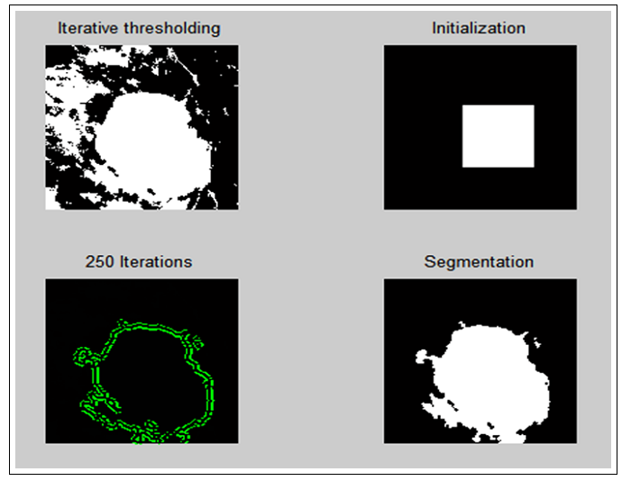 تشخیص سرطان پستان