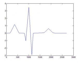 نویز زدایی الکتروکاردیوگرام