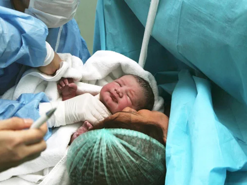 زایمان فیزیولوژیک