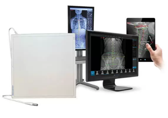 رادیو گرافی کامپیوتری