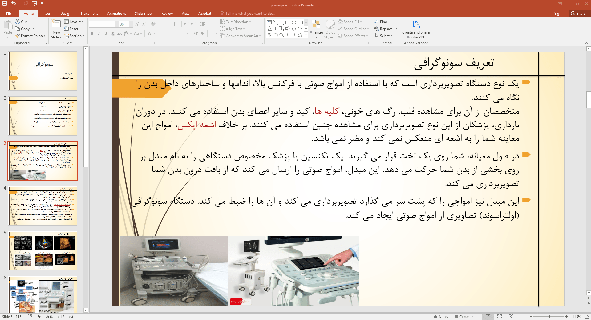 تعریف سونوگرافی