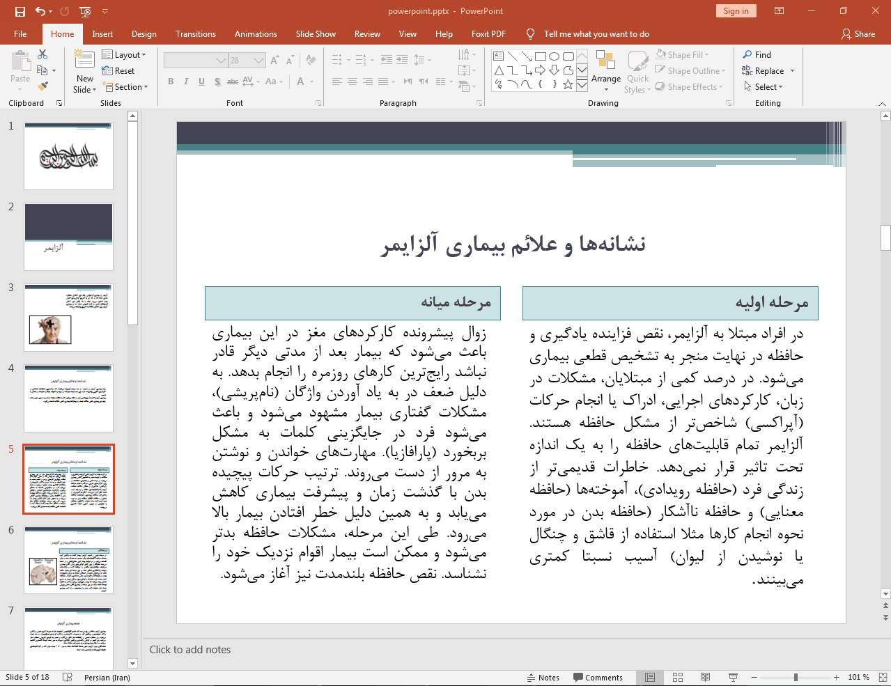 نشانه ها و علائم بیماری آلزایمر