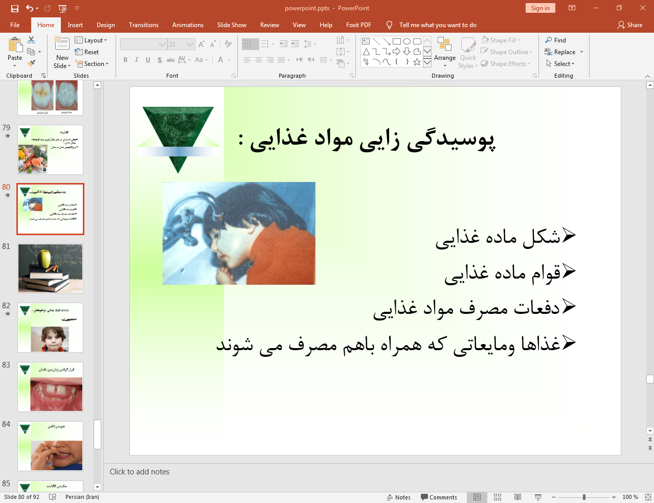 پوسیدگی