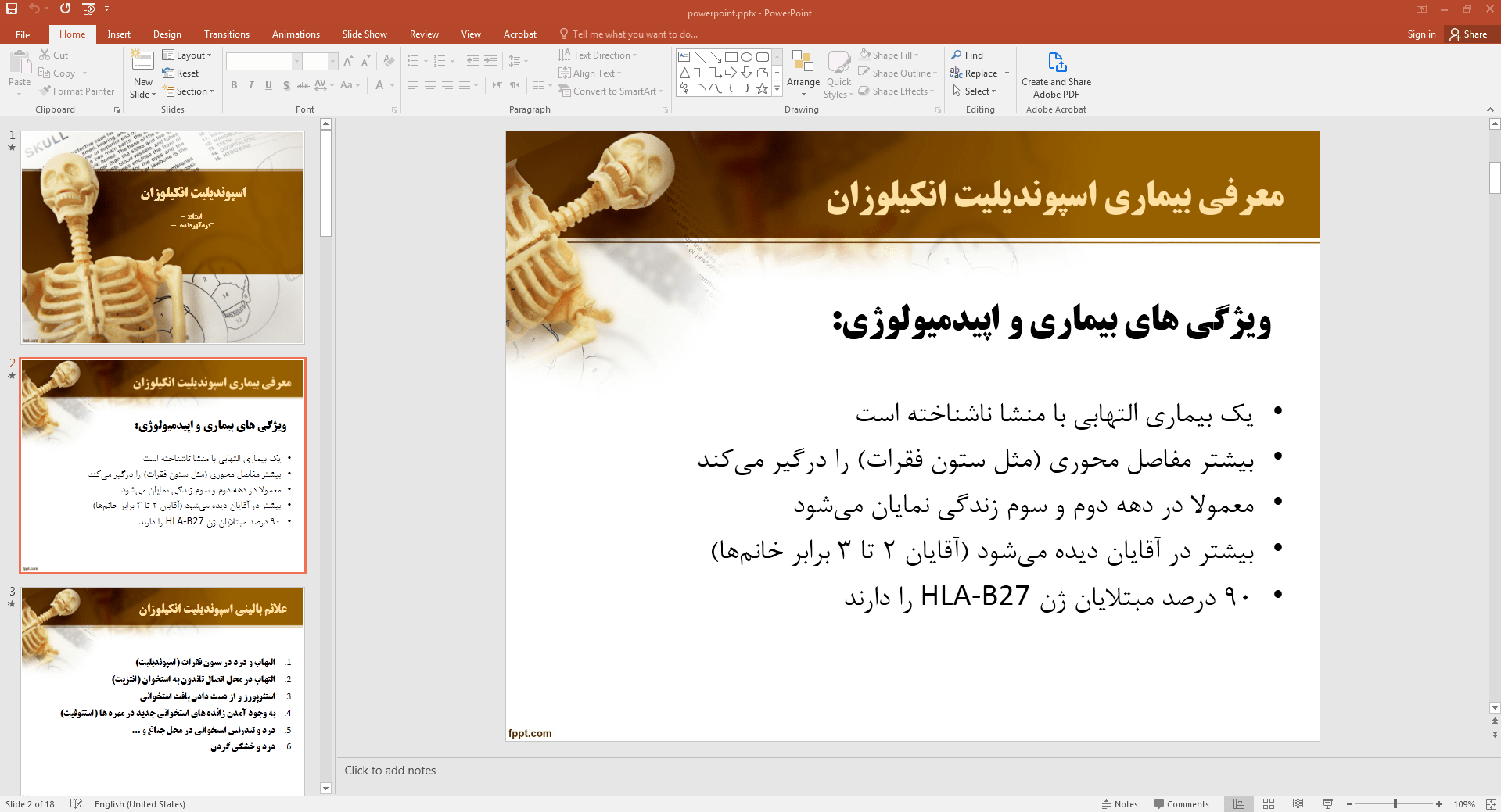 اسپوندیلیت انکیلوزان
