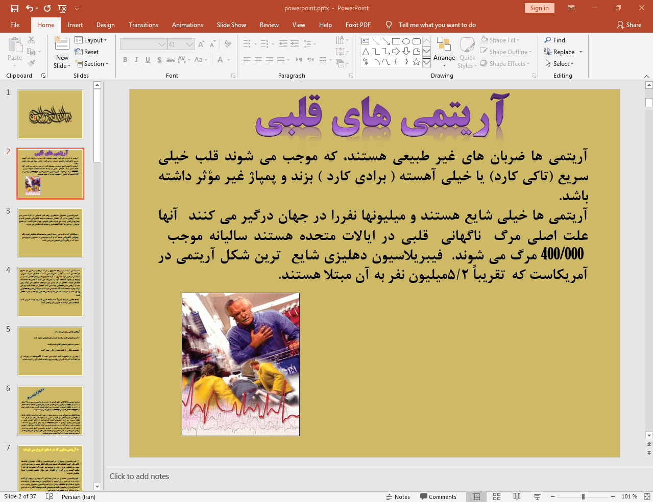 آریتمی قلبی