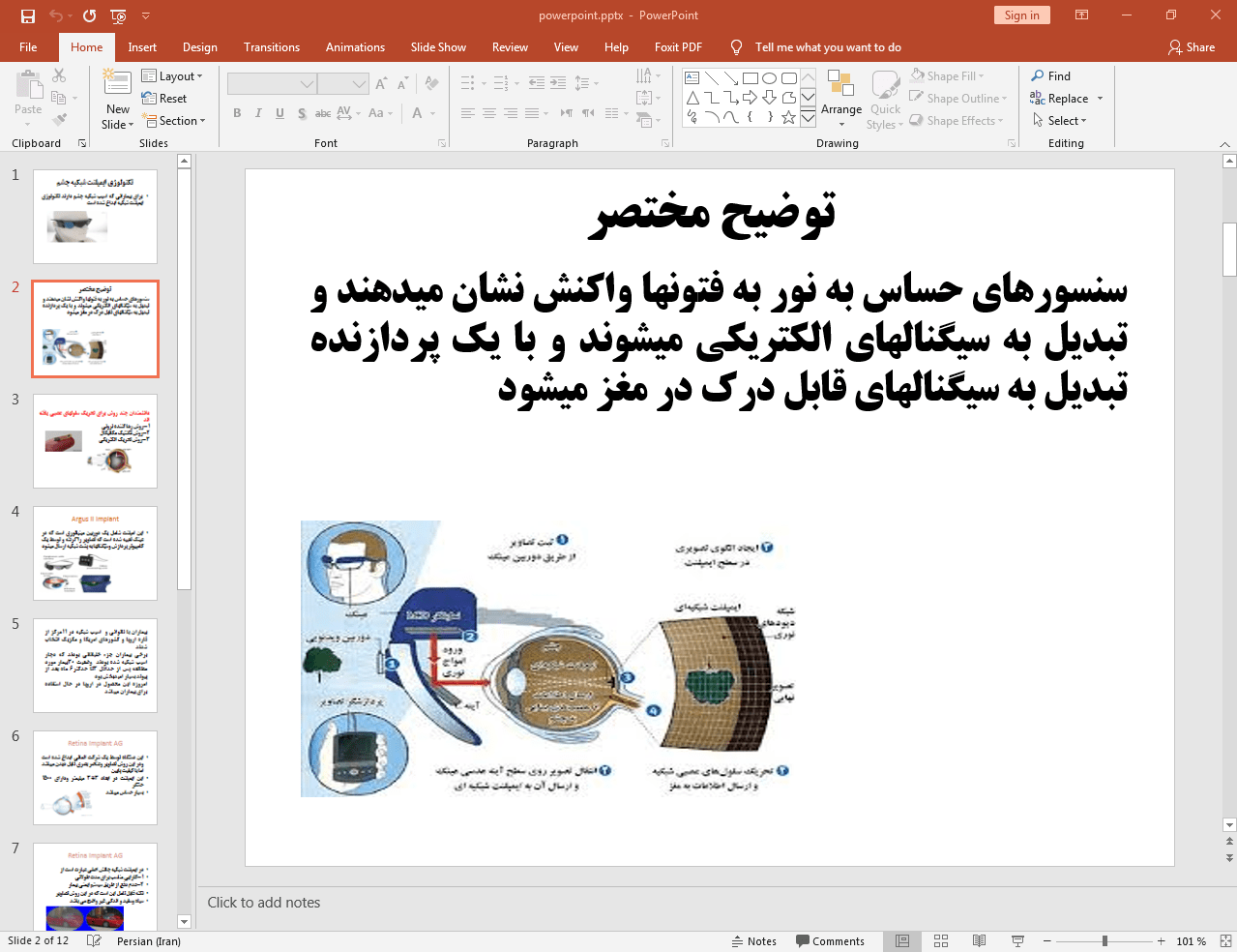 ایمپلنت شبکیه چشم