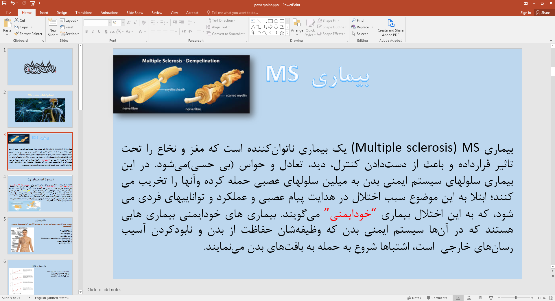 بیماری MS