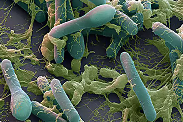بیماری بوتولیسم (Botulism)