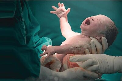 مراقبت پرستاری پس از زایمان