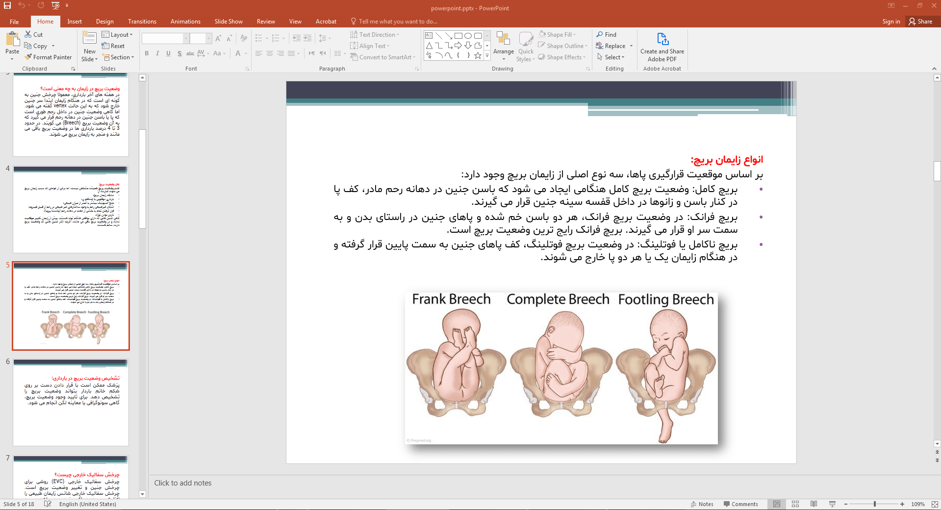 انواع زایمان بریچ
