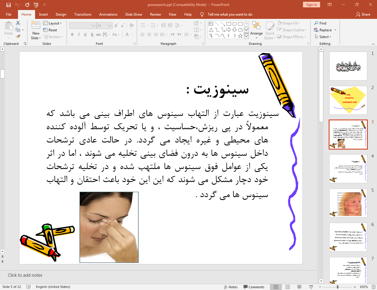 سینوزیت